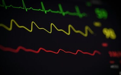 Infographie : soins de santé France-Suisse, un luxe pour beaucoup